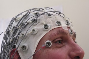 electroencefalograma